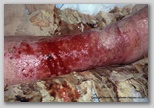 wound image
