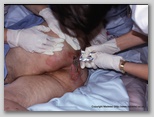 wound image