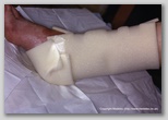 wound image