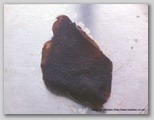 wound image