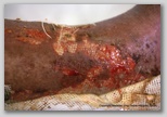 wound image