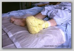 wound image
