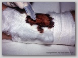 wound image
