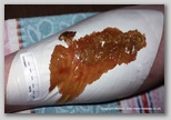 wound image