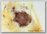 wound image