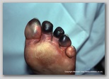 wound image
