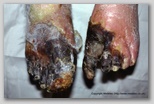 wound image