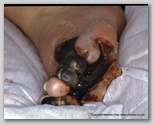 wound image