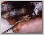 wound image