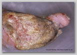 wound image